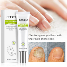 Load image into Gallery viewer, Nail Repair Treatment Gel