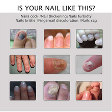 Load image into Gallery viewer, Nail Repair Treatment Gel